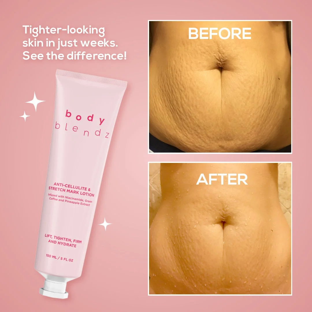 Body Blendz Anti-cellulite & Stretch Mark Lotion