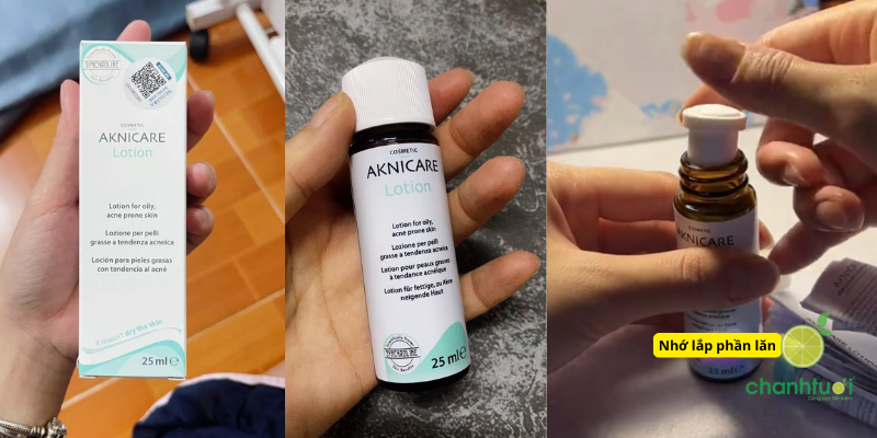 AKNICARE TREATMENT LOTION 3