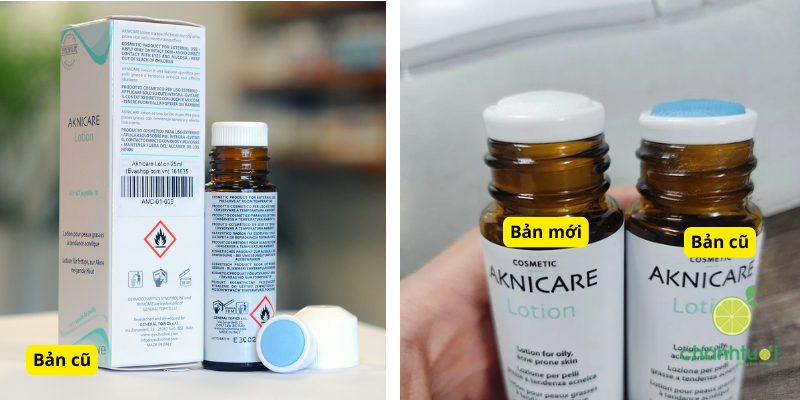 AKNICARE TREATMENT LOTION 4