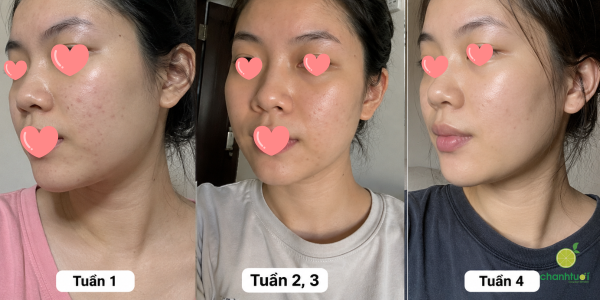 asap n20 peptide complex 3