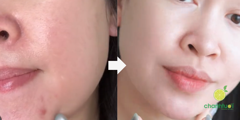 Asap Super B Complex 3