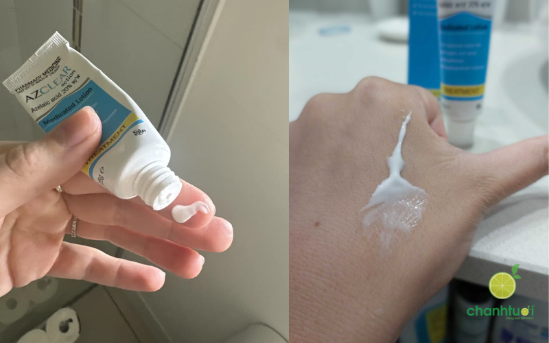 Azclear 20% Azelaic acid 3