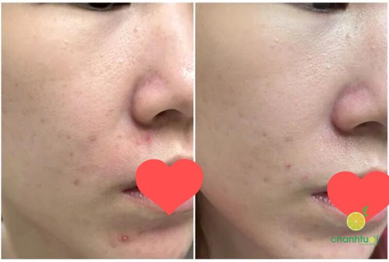 Bioderma Sensibio Defensive Serum 2