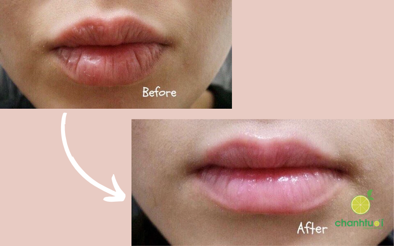 blistex medicated lip balm hiệu quả 2