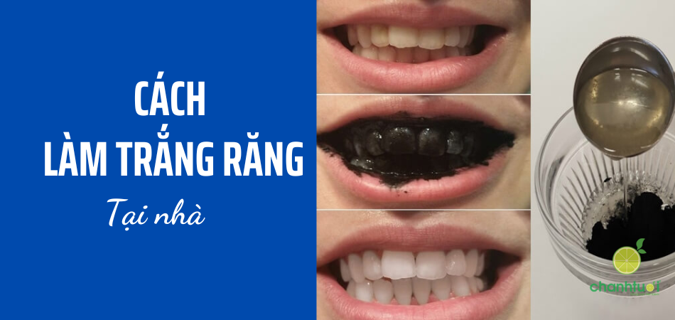 Tổng hợp 20+ cách làm trắng răng tại nhà nhanh chóng, hiệu quả nhất