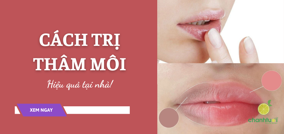 Chia sẻ routine 4 bước trị thâm môi vô cùng hiệu quả tại nhà!