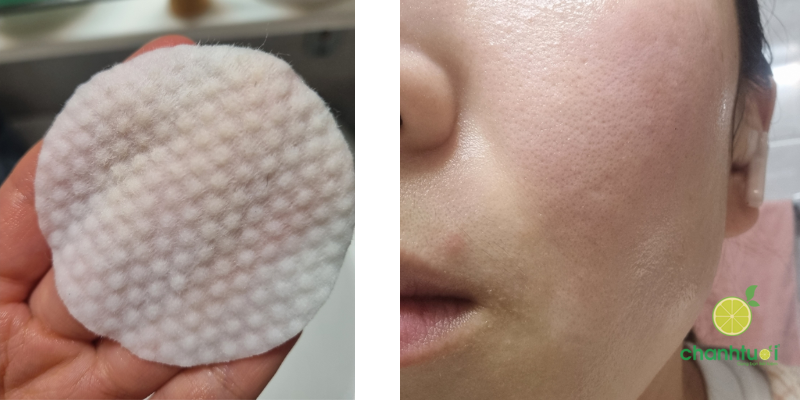 Cell Fusion C Pore Tox Pad 2