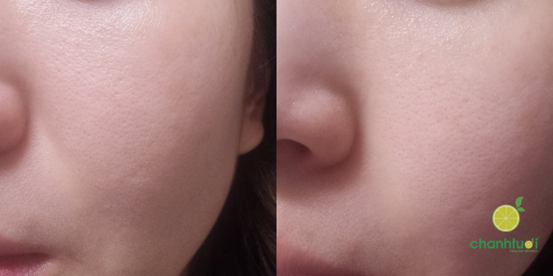 Cell Fusion C Pore Tox Pad 3