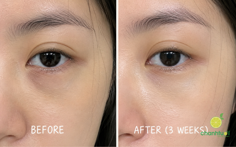 Creme Contour Des Yeux Vip O2 hiệu quả