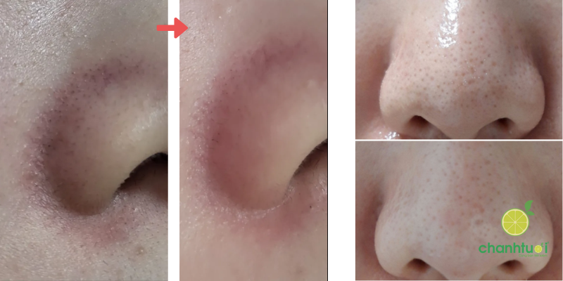 Dầu tẩy trang Make Prem 3