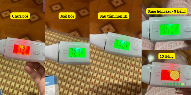 độ ẩm kem dưỡng kinetin