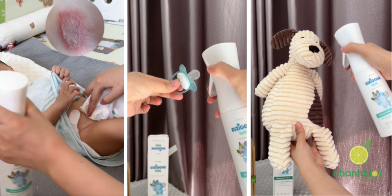 Dung dịch kháng khuẩn DIZIGONE 2