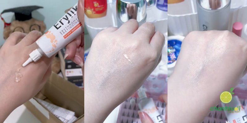 erylik gel kết cấu