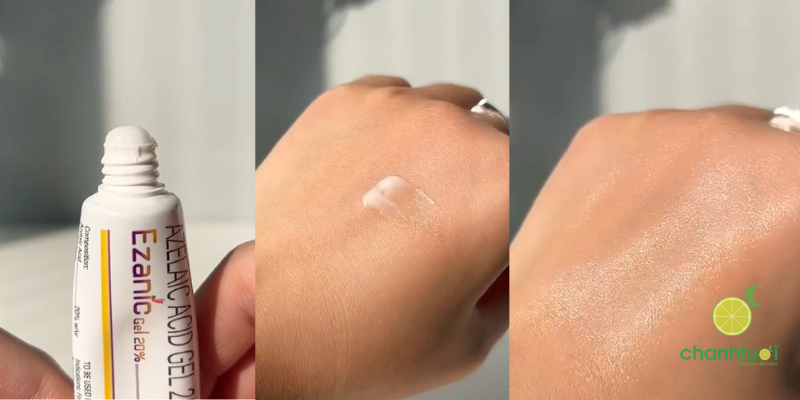 Ezanic Azelaic Acid Gel 20 kết cấu