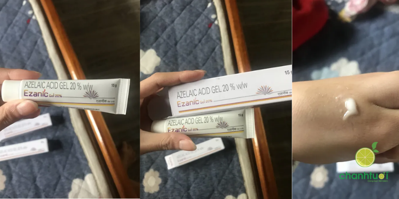 Ezanic Azelaic Acid Gel 20