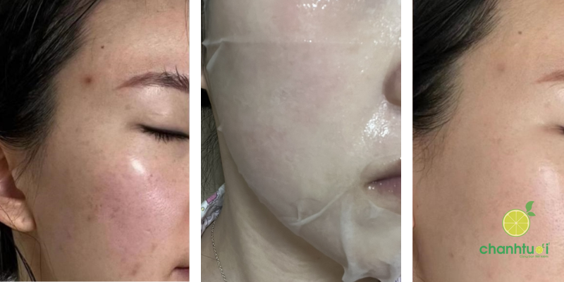 first cooling mask 2