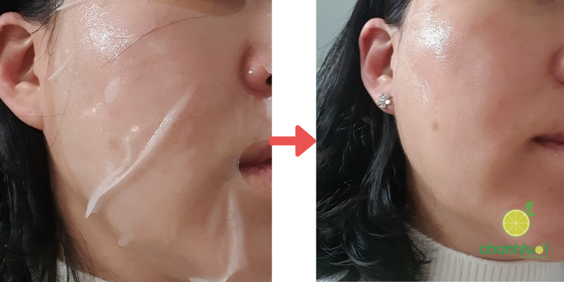 first cooling mask 5