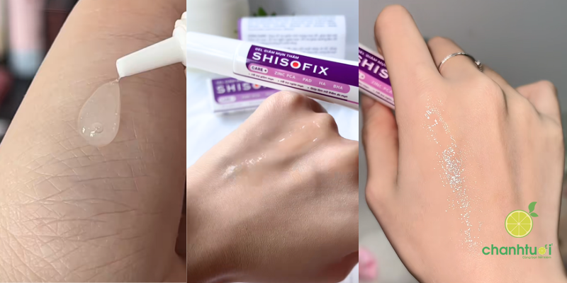 Gel Giảm Mụn Thâm Shisofix 2