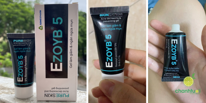 Gel mụn Ezoyb 5 5