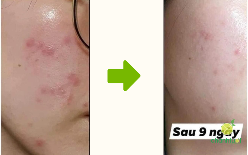 gel rửa mặt biotrade 6