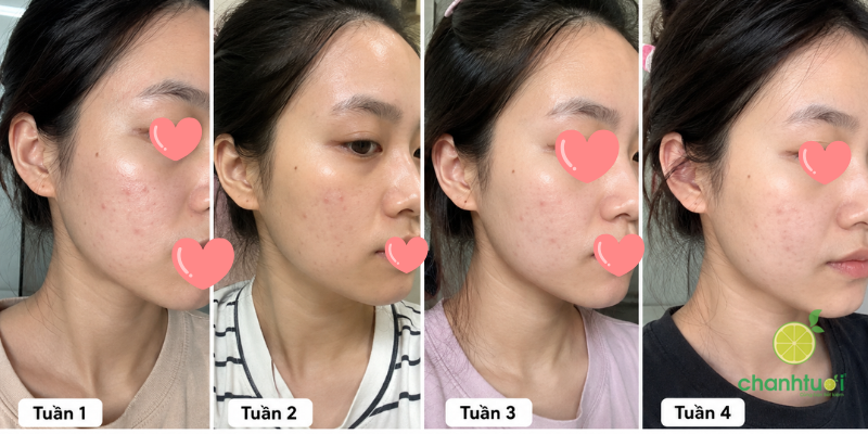 gel rửa mặt Librederm 3