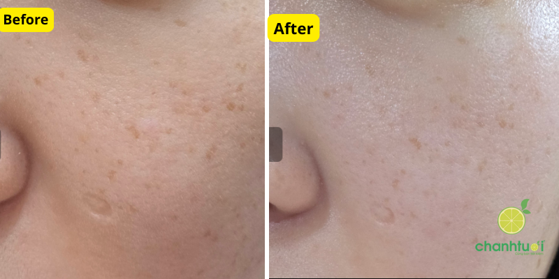 goodal green tangerine vita c dark spot serum 2