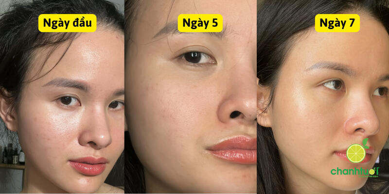 hiệu quả B512 Bioverse