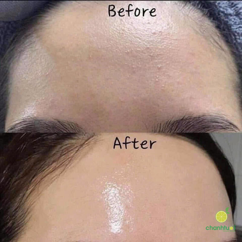 hiệu quả lotion p50 