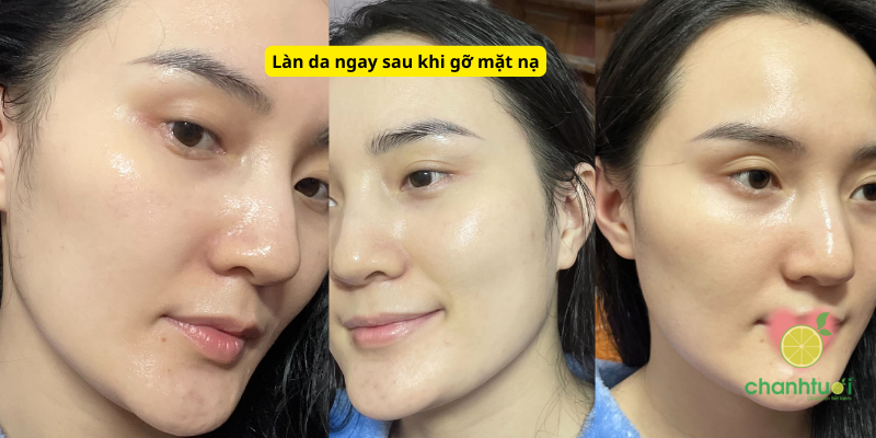 hiệu quả mặt nạ Caryophy 2 (1)