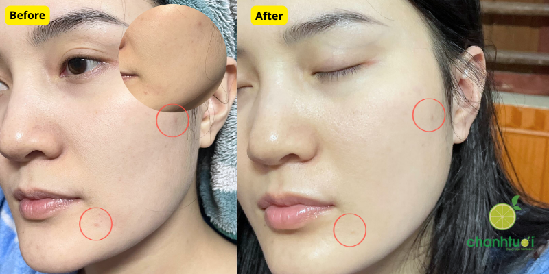 hiệu quả mặt nạ Caryophy