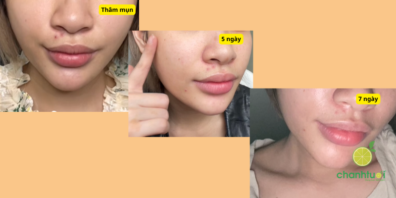 hiệu quả serum vitamin C Garnier 2