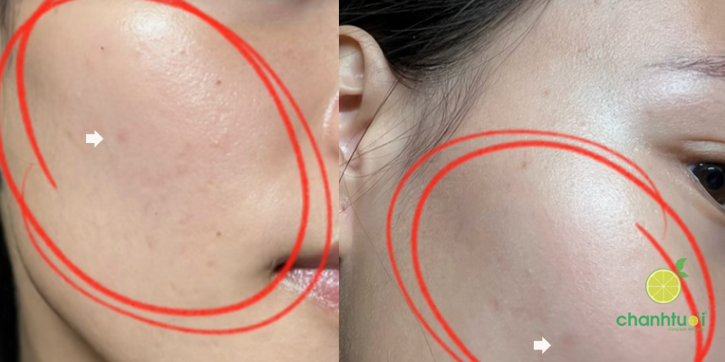 hiệu quả serum vitamin C Garnier