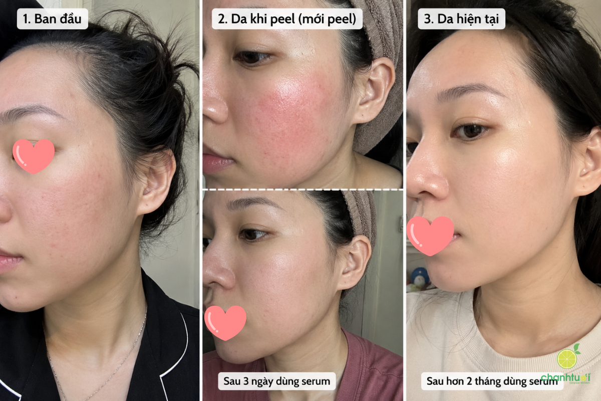 Hydrinity Restorative HA Serum hiệu quả