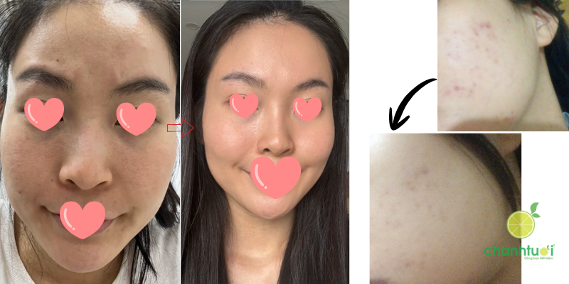 innoskin b3 serum thành phần (1)