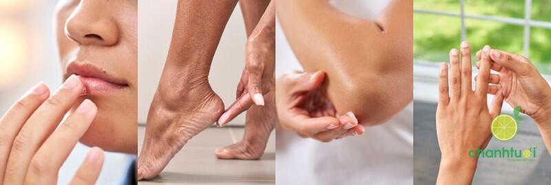 kem đa năng aquaphor 01