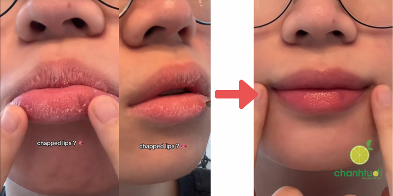 kem đa năng aquaphor 2