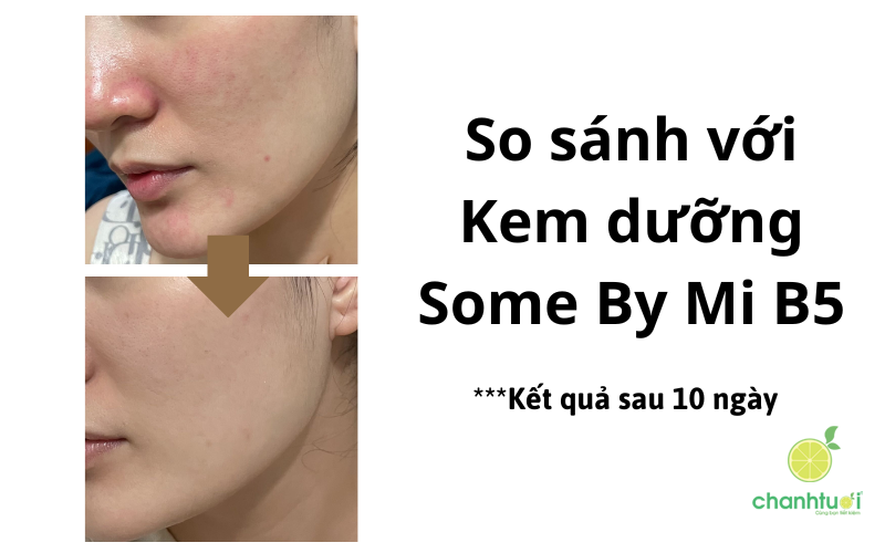 kem dưỡng 345 Relief Cream 7 (1)