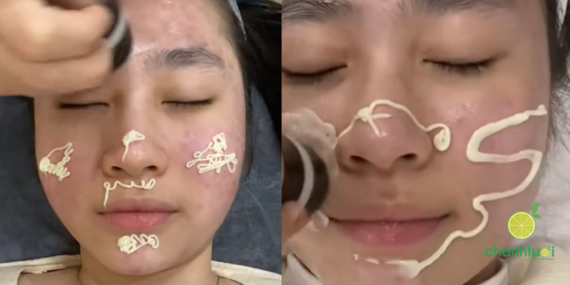 kem dưỡng ẩm Ducray Keracnyl PP