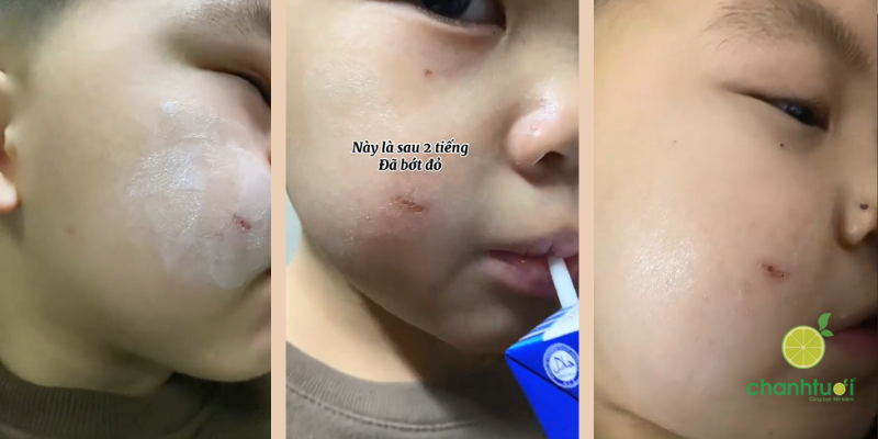 Kem dưỡng ẩm La Roche Posay Cicaplast Baume B5+ hiệu quả 3