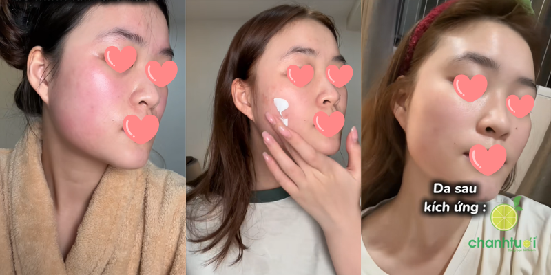 Kem dưỡng ẩm La Roche Posay Cicaplast Baume B5+ phục hồi