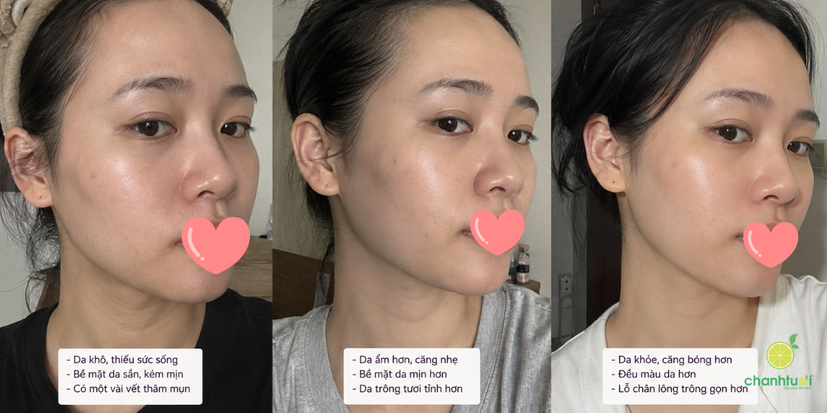 kem dưỡng Asap DNA Renewal Treatment hiệu quả