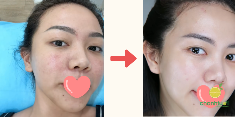 kem dưỡng BEPLAIN PDRN hiệu quả 2