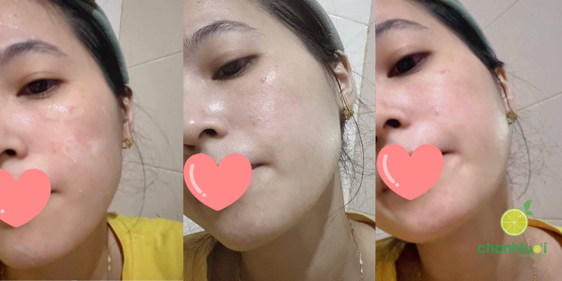 Kem dưỡng Beyond 100h Barrier Cream cảm nhận