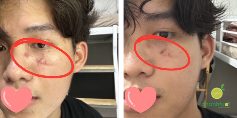 kem dưỡng bioderma tím hiệu quả 1