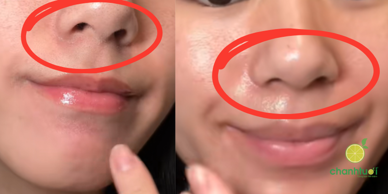 kem dưỡng bioderma tím hiệu quả 2