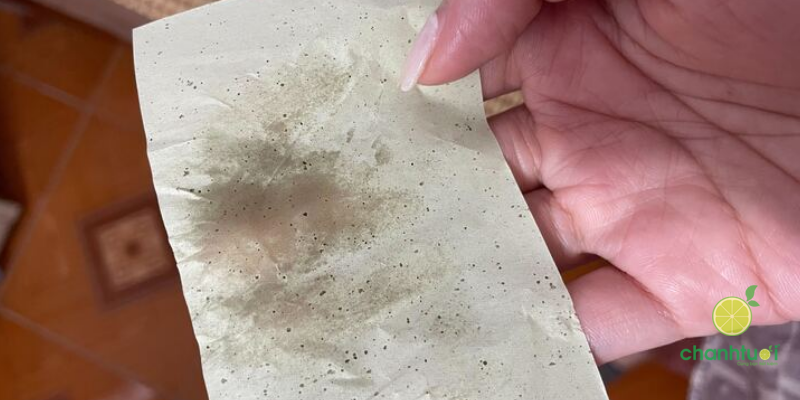 _kem dưỡng kinetin kiềm dầu