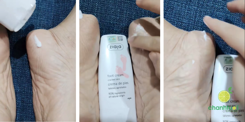 Kem Dưỡng Nứt Nẻ Gót Chân Ziaja Foot Cream 2