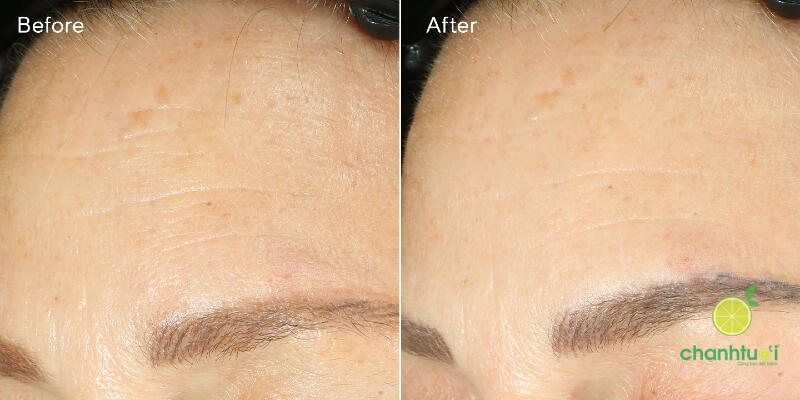 kem dưỡng retinol murad 2