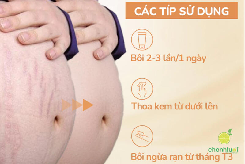 Kem mờ rạn da Lovin'Skin Mama 5