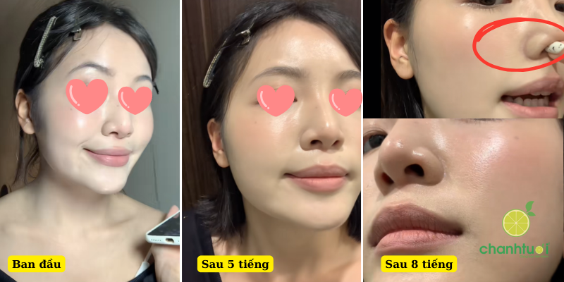 kem nền colorkey 3